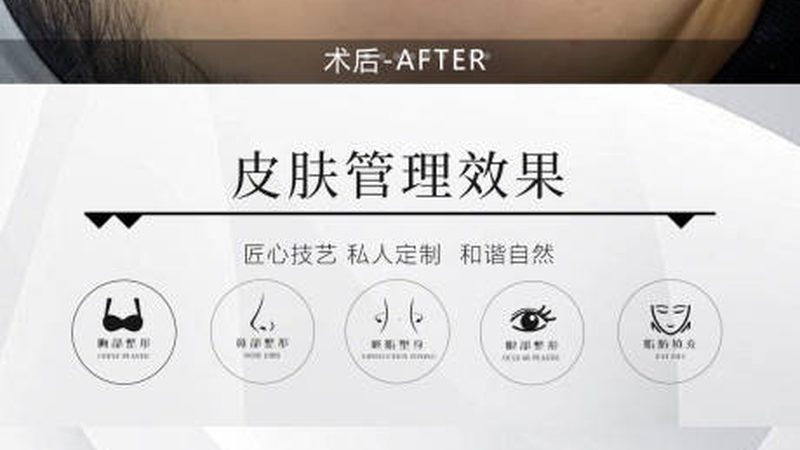 小标题：术后恢复，饮食是关键