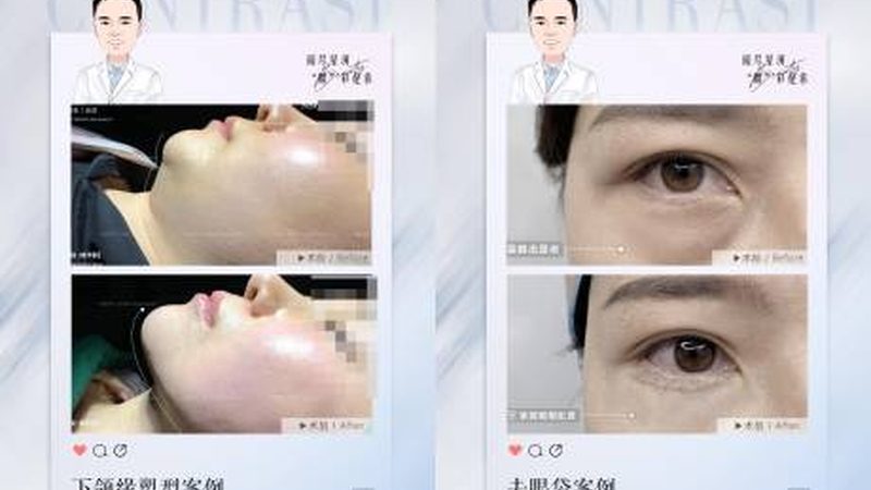 揭秘进口水光针：价格背后的秘密与选择指南