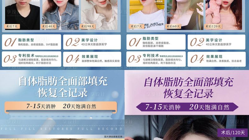 超声炮家用，如何选择靠谱品牌？揭秘十大热门品牌排名**