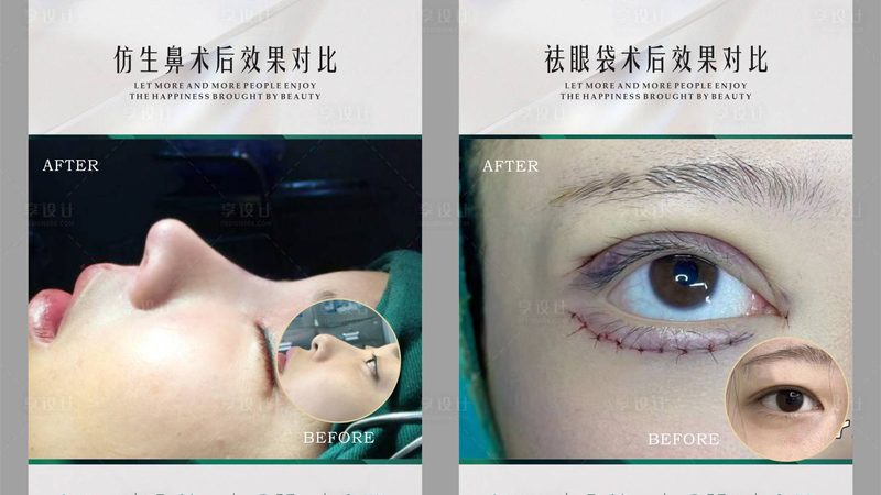 抗衰与紧致，面霜还是仪器？揭秘两者间的秘密**