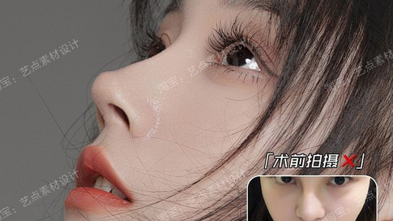 光子嫩肤仪器：揭秘厂家直销背后的秘密