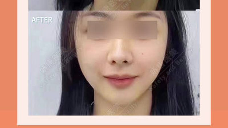 术后黄金72小时，你的护肤可能全做错了