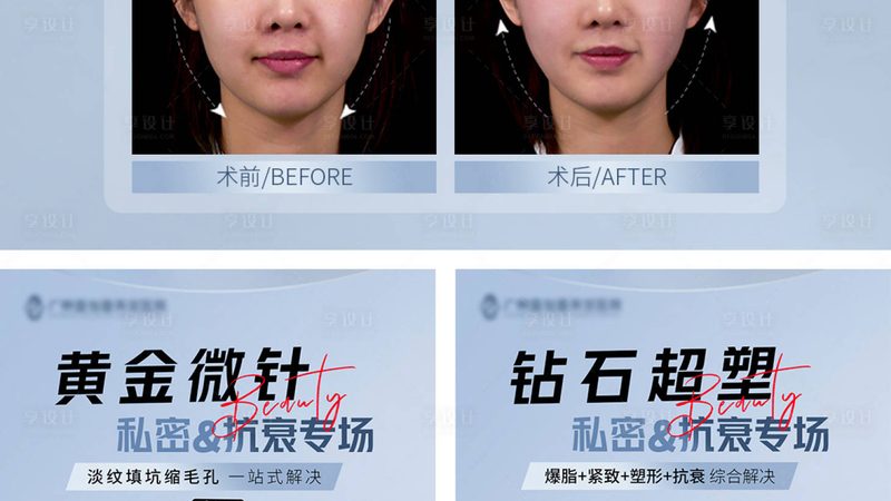 热玛吉2025价格解析：揭秘疗程次数与标准