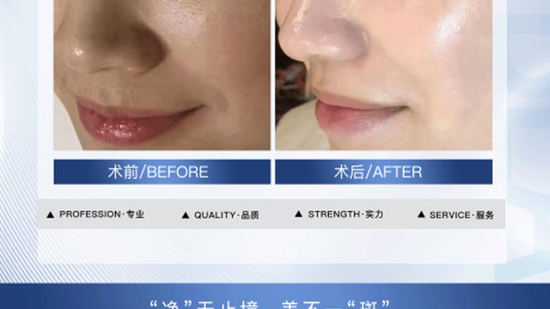 皮肤管理设备定制与代理：揭秘定制化美容科技背后的秘密