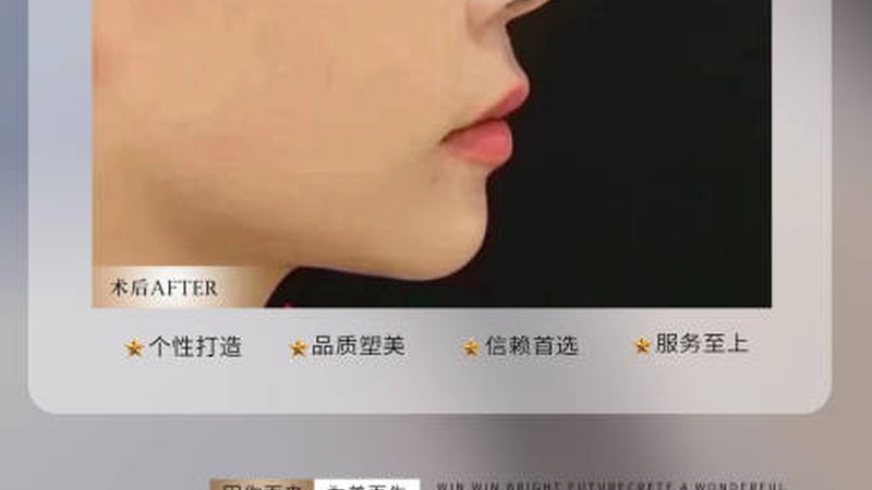 重庆隆鼻材料国产和进口区别