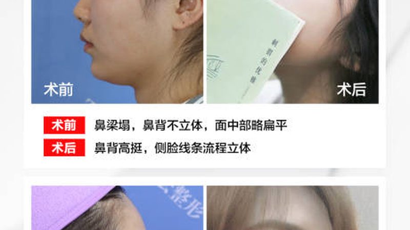 瘦脸与双下巴，如何选择合适的产品？**