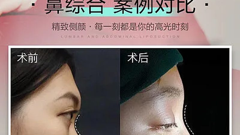 为了避免超声炮治疗间隔时间不当，以下是一些建议：