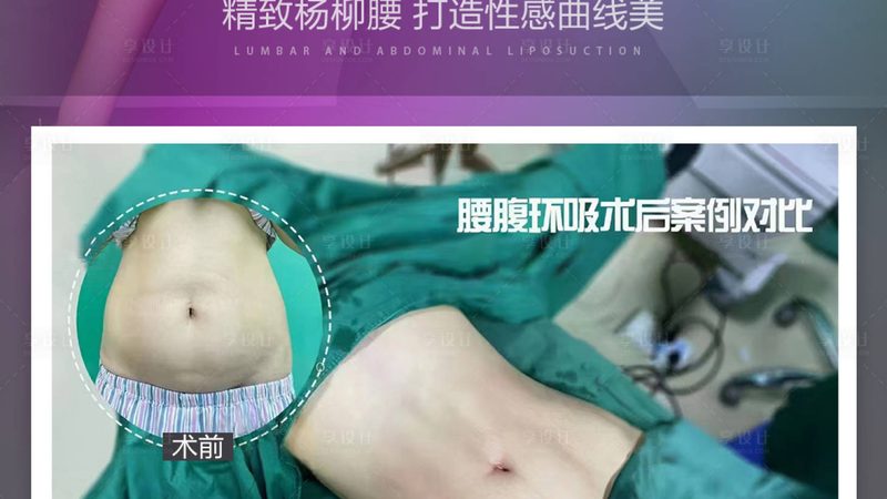 45岁以上的女性，肌肤衰老程度更加明显，需要综合抗衰老方案。以下项目可供选择：