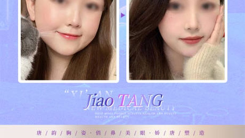 埋线提升PDO线价格乱象背后：厂家直销的真实逻辑