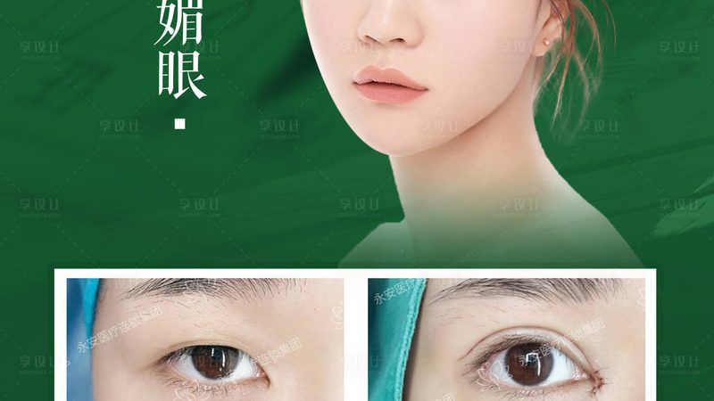 膨体鼻综合流程：揭秘整形美容的精致细节