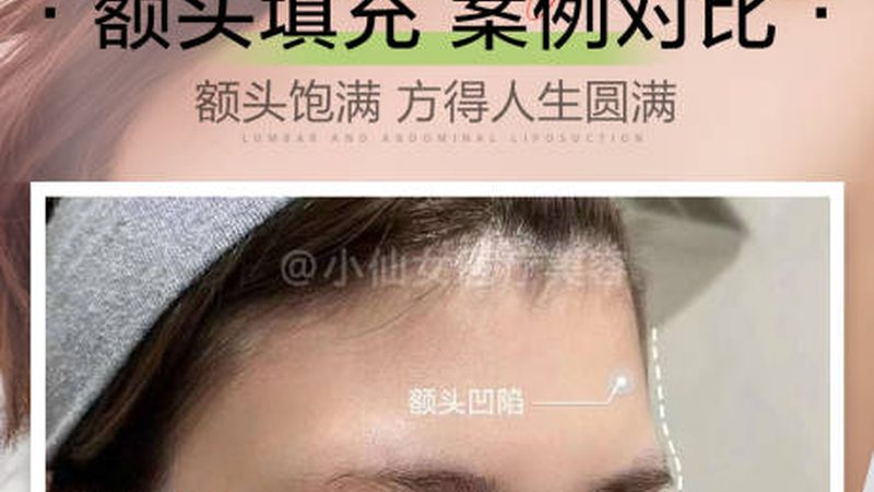 昆明激光祛斑，2025年价格解析与选择要点